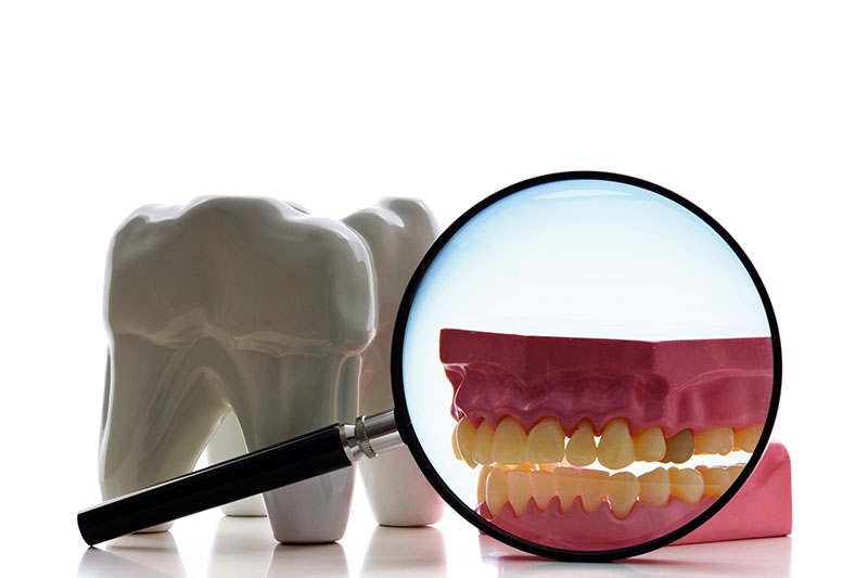 model of a tooth next to a whole mouth on the root canal page